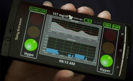 Pncreas virtual torna celular parceiro de pacientes de diabetes