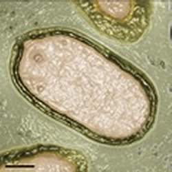 Pandoravírus: vírus gigante é elo perdido entre vírus e bactérias