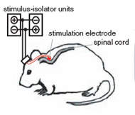Mal de Parkinson é controlado com estímulos elétricos na medula