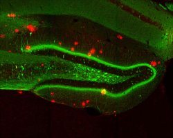 Memria de ratos com Alzheimer  recuperada com luz