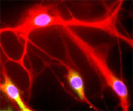 Descoberto como clulas-tronco se transformam em neurnios
