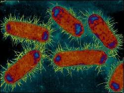 Superbactéria pode causar epidemia global, alertam cientistas