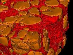 Imagens virtuais de tecidos mostram doenças em 3D