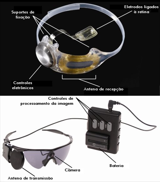 Termina primeiro teste de olho binico