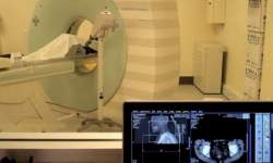 Especialistas alertam sobre riscos da radiação durante tomografias computadorizadas