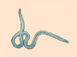 Verme parasita vira nova arma contra alergias