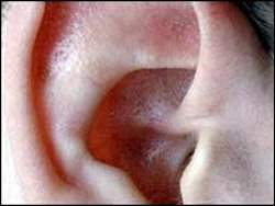Uso de Viagra pode levar  perda de audio