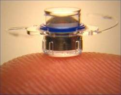 Minitelescópio implantável no olho ajuda pacientes com problemas de visão